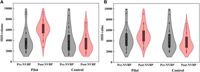 The impact of Chinese volume-based procurement on pharmaceutical market concentration